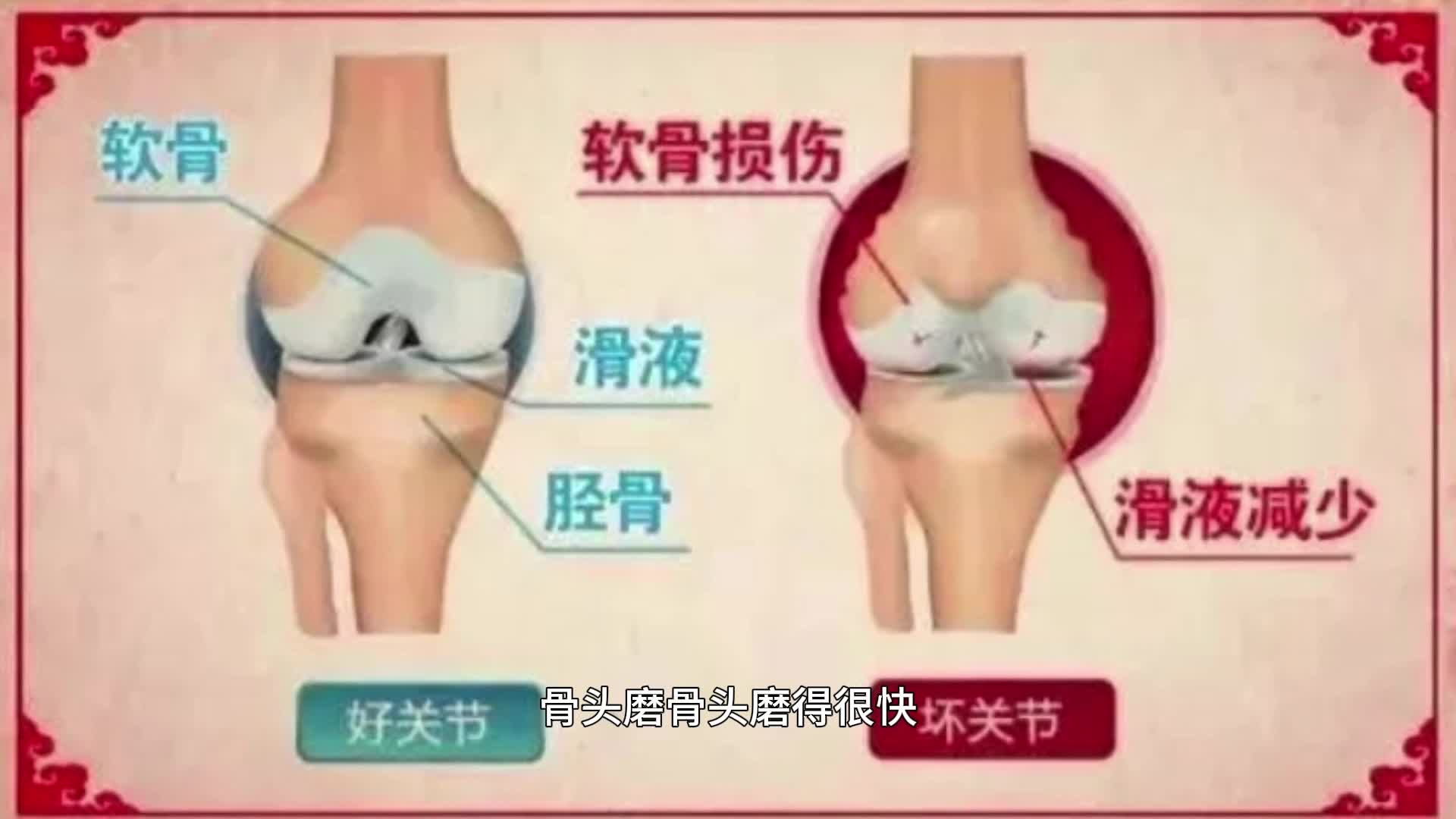 膝关节痛的原因及治疗方法